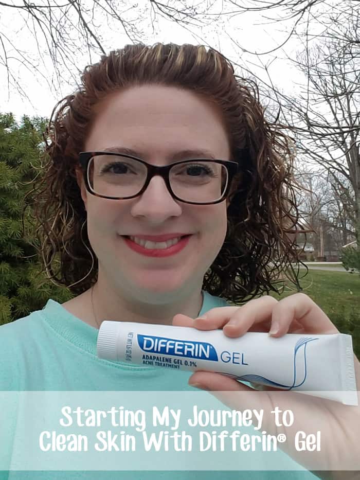 Starting My Journey to Clean Skin With Differin® Gel